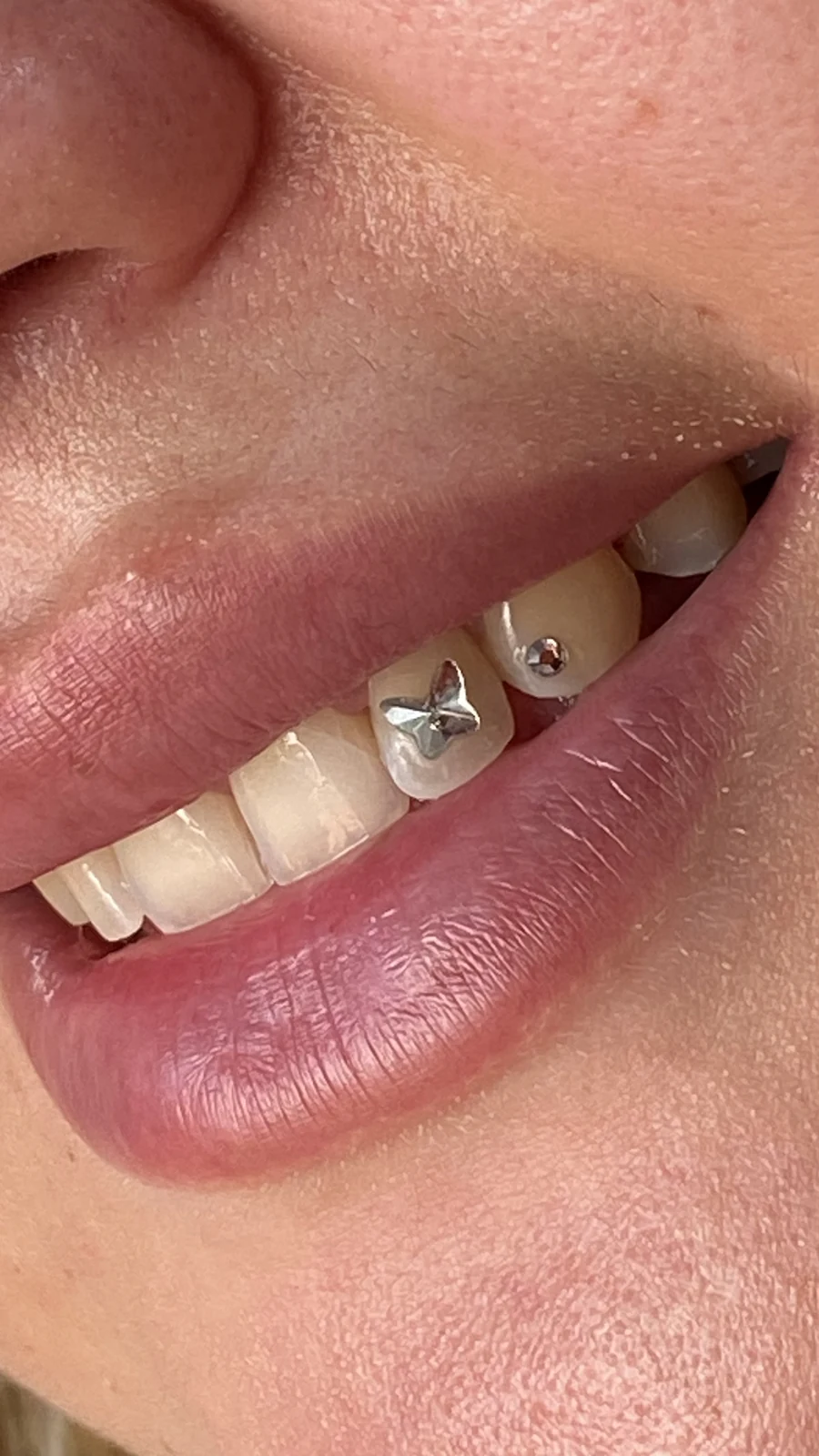 Trabajo de toothgems realizado por Aurea en No Glory Tattoo Parlour