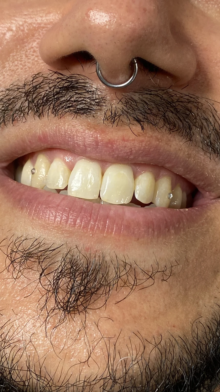 Trabajo de toothgems realizado por Aurea en No Glory Tattoo Parlour